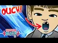 OperationOuch - Broken Bones and Busted Teeth Science for Kids