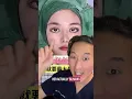 Some Asian Plastic Surgeons Are Insane