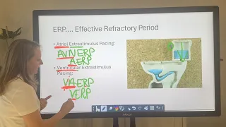 ERP - Effective Refractory Period