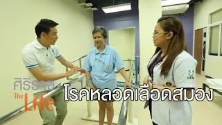 การรักษาโรคหลอดเลือดในสมองแบ่งเป็นกี่ระยะ และแต่ละระยะมีวัตถุประสงค์อย่างไร