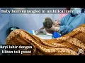 Download Lagu Bayi lilitan tali pusar bisa lahir normal||Birth baby vlog||Parto normal|| Partos normal