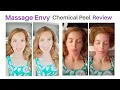 Massage Envy Facials Chemical Peel Review