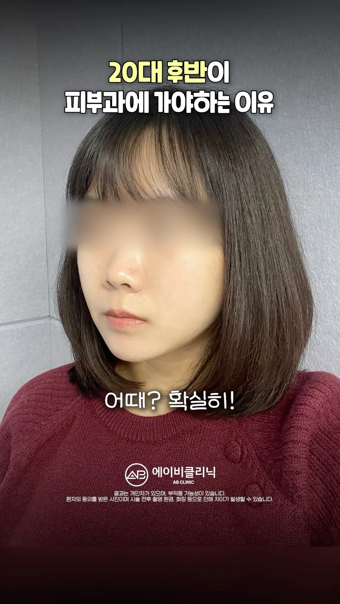 20대 후반부터 피부과 찾는 이유