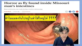 แมลงวันสามารถอยู่ในลำไส้ใหญ่ได้อย่างไร