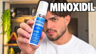 MINOXIDIL em Espuma (Kirkland Foam)