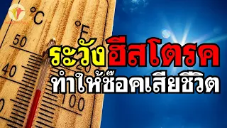  โรคฮิสโตรกเกิดจากอะไร และมีอาการอย่างไรบ้าง 