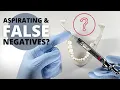 What Most Dentists Don t Know About Aspirating OnlineExodontia com