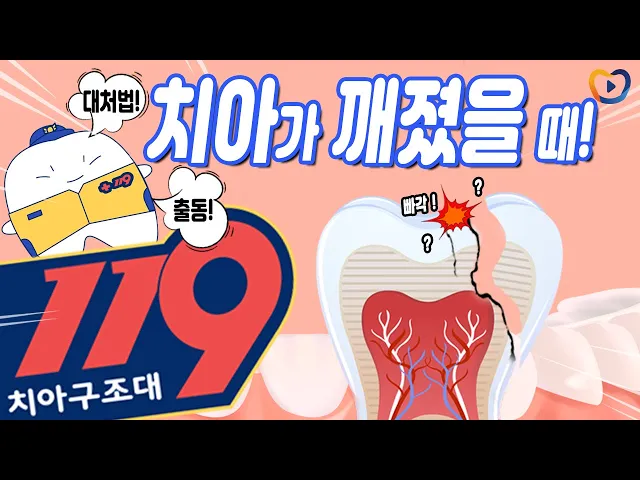 [119치아구조대] 치아가 깨졌을 때!?ㅣ깨진 순간부터 치료까지 올바른 대처법!ㅣ대처법ㅣ치료방법ㅣ레진