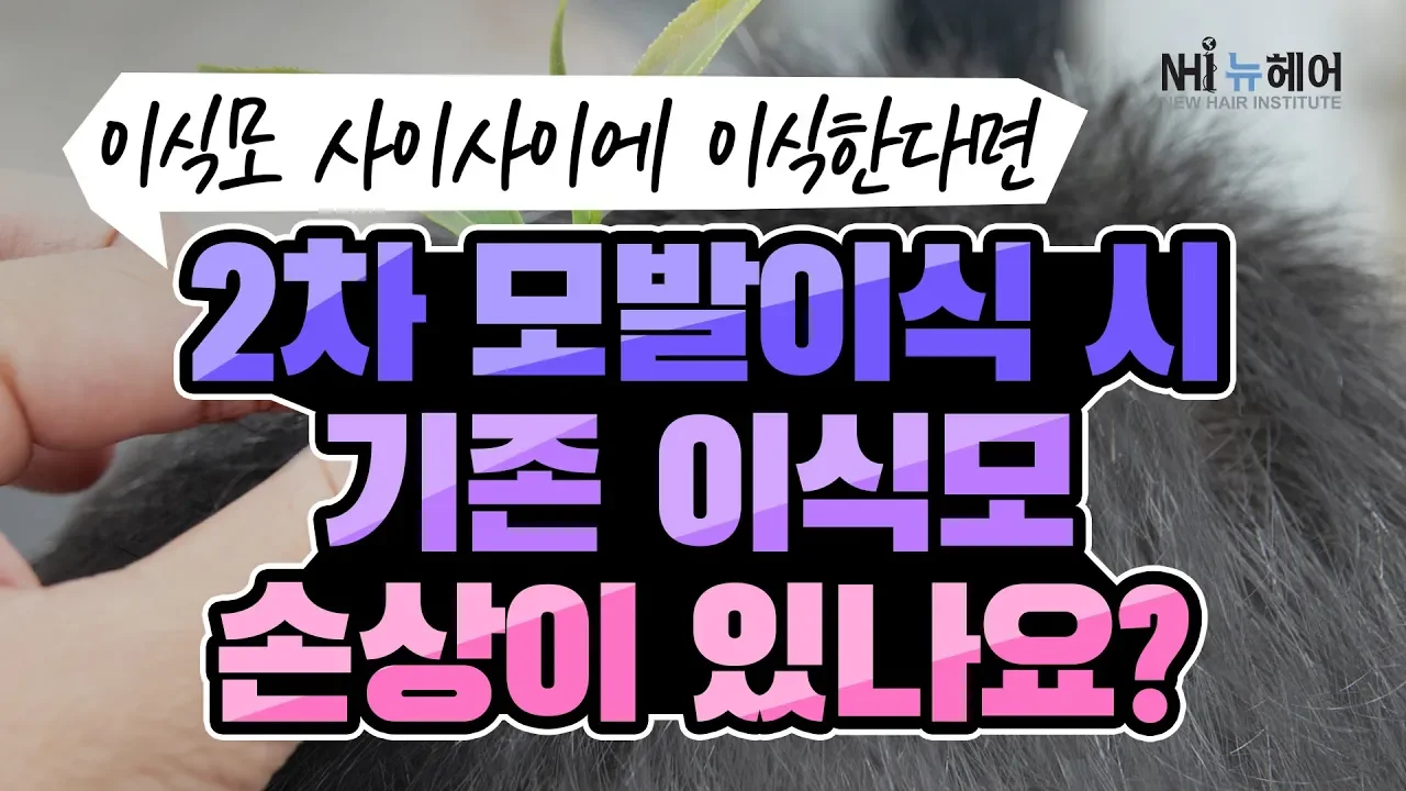 2차 모발이식 때 1차 이식모 사이에 이식하면 기존 이식모에 손상이 있을까? - 뉴헤어 I 모발이식 I 탈모QnA I