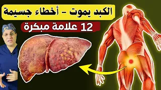12 علامات غريبة تشير إلى أنك تعاني من تلف الكبد وموت الكبد معلومات صحية مفيدة إزالة سموم الكبد  12 علامات غريبة تشير إلى أنك تعاني من تلف الكبد وموت الكبد معلومات صحية مفيدة إزالة سموم الكبد