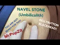 UMBILICOLITH Giant bellybutton blackhead Extremely rare to see You won t believe how deep it goes