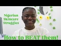 Download Lagu Nigerian Skincare Struggles—And How I BEAT them!