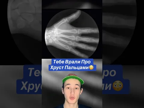 Тебе Врали Про Хруст Пальцами!😳 #shorts #факты #руки