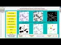 Malaria Detection Using Image Processing IEEE Based Projects With Source Code