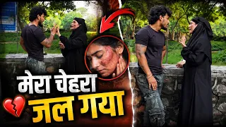 मेरा चेहरा जल गया 💔😭 अब हम नहीं रहे सकते साथ||rathore Nikku