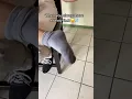 Relatable Dermadry s iontophoresis device for sweaty feet