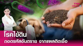 แพทย์วินิจฉัยโรคไข้ดินอย่างไร