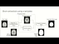 9 0 - MRI brain extraction using a template