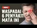 Lagu 6 Penyakit Mata yang Tidak Bisa Disepelekan | SINAU