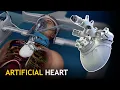 Download Lagu Fully Implantable Artificial Heart