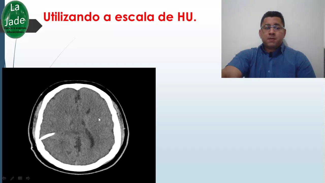 A escala de Hounsfield (HU) na Tomografia Computadorizada (TC)