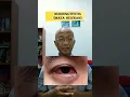 Download Lagu Konjungtivitis (Mata Belekan)| dr. Basuki Rokhmad