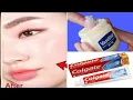 Toothpaste and vaseline face mask get wrinkle free glowing skin instant result
