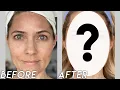 Musely Face Rx Did it Work I tried Musely to treat my Melasma - Over 40