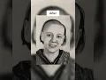 People before and after lobotomy