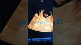 الاسبوع الثامن حين تنمو الحياة 