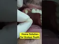 Quick Home Solution for Broken Tooth #shorts