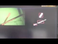 Multiple objects tracking usiing FPGA