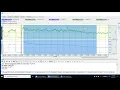Analyzing EMG Data in BIOPAC