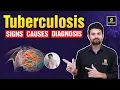 Tuberculosis - Signs Causes Diagnosis Treatment Nursing Important Topic Sagar Sir