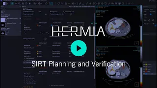 Hermia SIRT For Selective Internal Radiation Therapy 