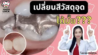  วัสดุอุดฟันสีดำที่เห็นชัดเมื่ออ้าปาก มีทางเลือกเปลี่ยนเป็นสีเหมือนฟันได้หรือไม่ 