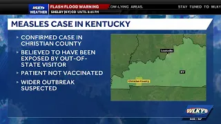 Case of measles confirmed in southwestern Kentucky s suspect outbreak