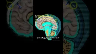 جربت طريقة د مجدي يعقوب في غسيل المخ وهيا قيام الليل 