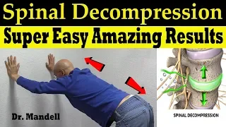 Spinal Decompression Made Super Easy With Amazing Results - Dr Alan Mandell DC