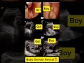 Baby Gender reveal. #ItsABoy  #ItsAGirl  #BoyOrGirl  #BabyReveal  #MomToBe #DadToBe  #BabyOnTheWay