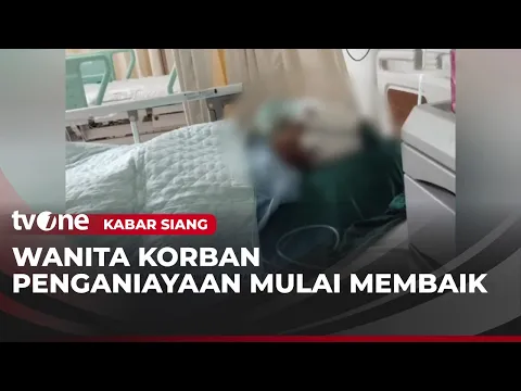 Kondisi Korban Penganiayaan Semakin Membaik, RSHS akan Maksimalkan Perawatan