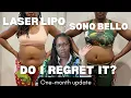 I m 49 and I Had a Tummy Tuck at Sono Bello See My Before After Part One