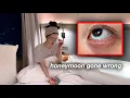 Download Lagu Got a Nasty Eye Infection during Romantic Honey Moon