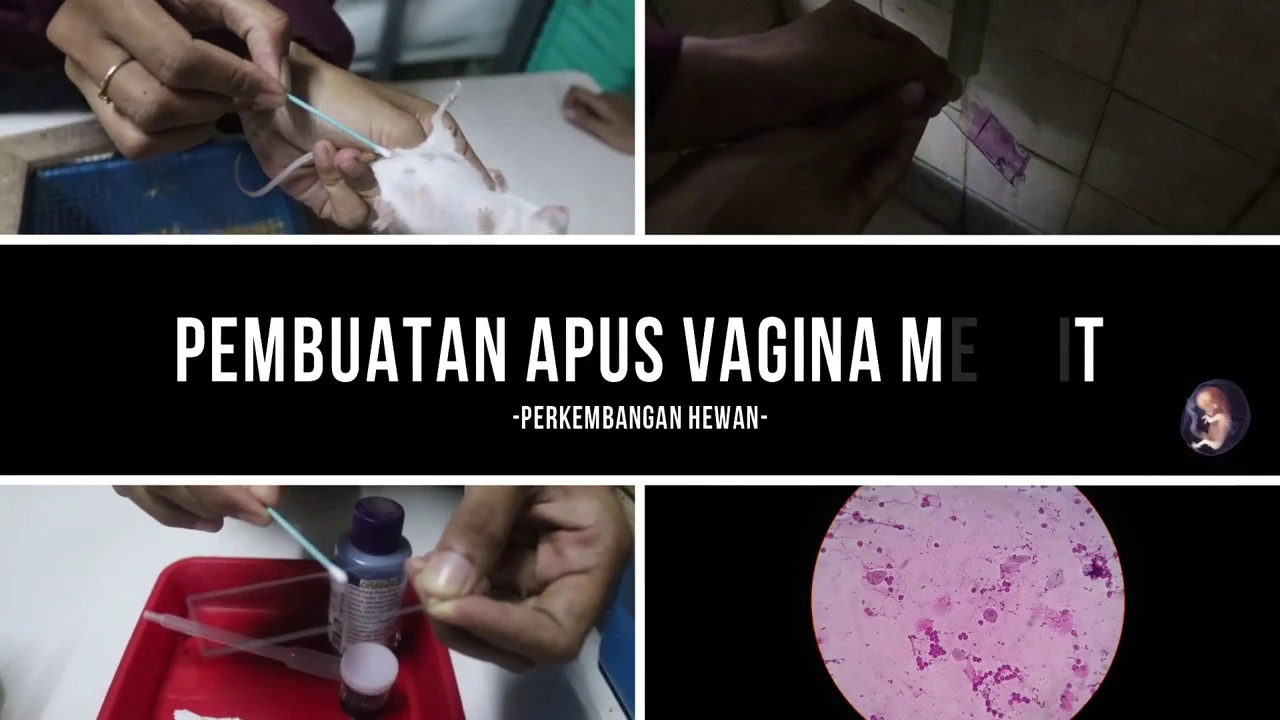 How to Use COPAN's ESwab for Vaginal Specimen Collection (Viewer Discretion Advised). 