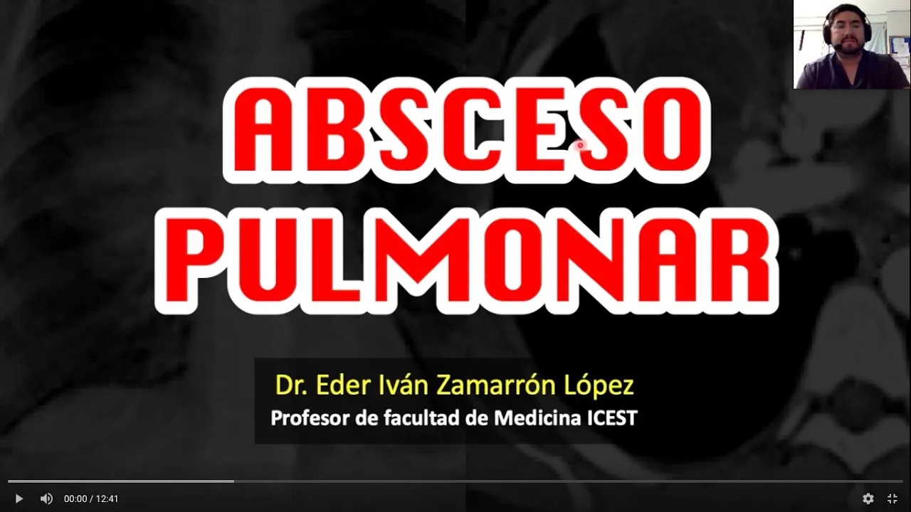Absceso Pulmonar un “Vistazo rápido”