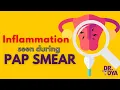 Inflammation Seen on Pap Smear