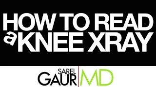 How to Read a Knee X-ray