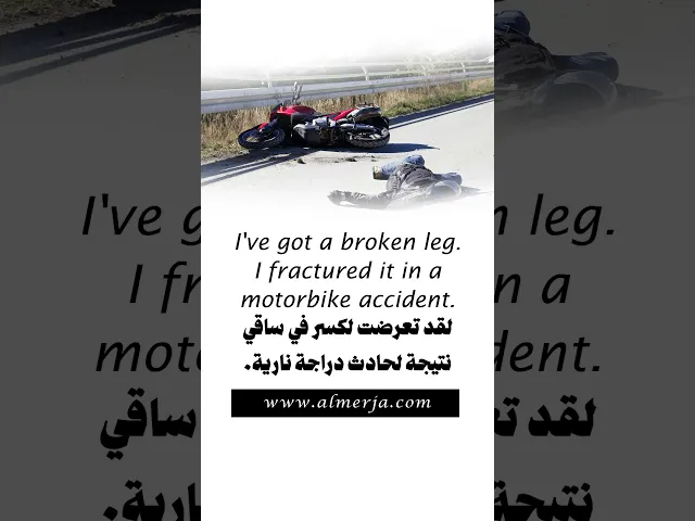 ⁣I've got a broken leg. I fractured it in a motorbike accident
