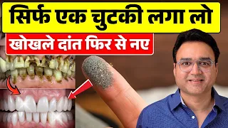 ये आयुर्वेदिक दन्त मंजन लगा लो - कीड़ा लगे, पीले, खोखले दांत फिर से नए कर देगा | Teeth Cavity