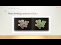 4 - 3 Watershed Algorithm Segmentation